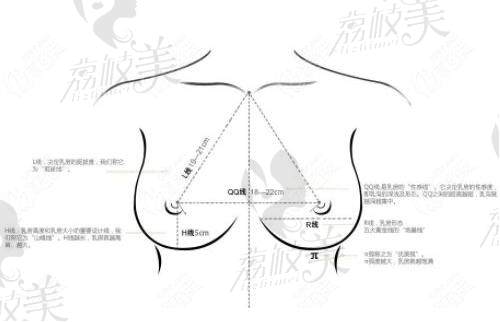 广州中家医缩胸手术医院