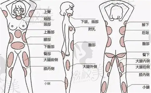 广州曙光美容医院内哪个医生吸脂比较好