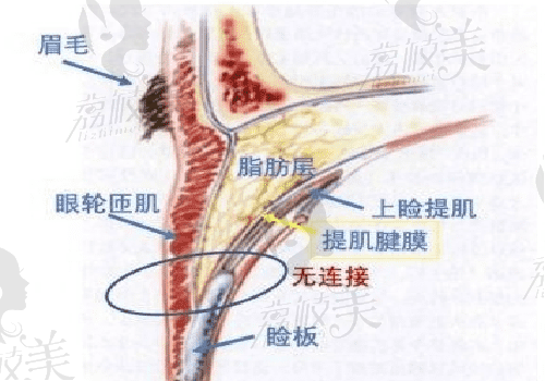 苏州维多利亚眼整形图