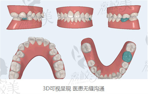 福能海峡口腔种牙哪个医生好