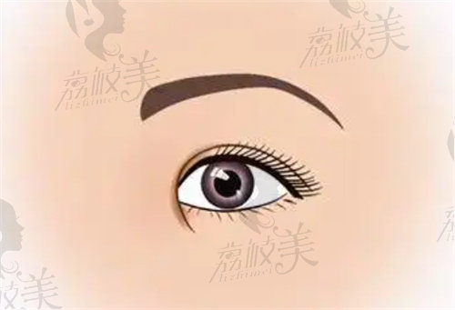 林晓燕医生修复疤痕肉条眼的眼修复手术的技术特点