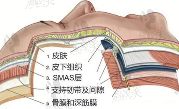 李曉東PST面部提升技術高超