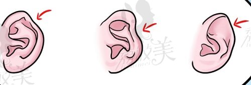 河南省中医一附院七月初耳畸形专场活动什么时间？
