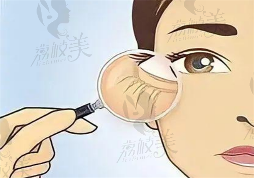  苏州维多利亚双眼皮图