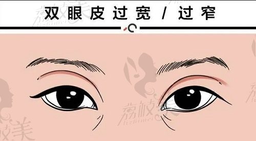 陳三群雙眼皮技術(shù)怎么樣？