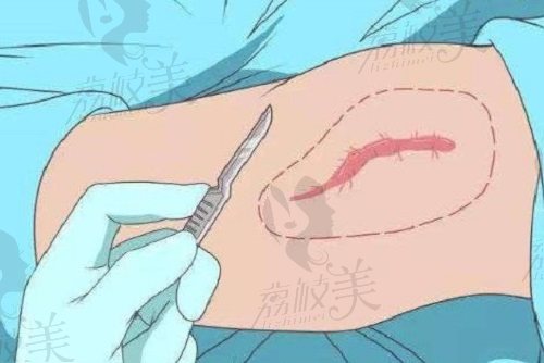 贵阳华医医院是正规医院吗