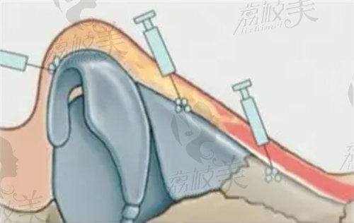 广州医选医疗美容整形特色是什么