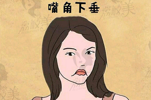 嘴角下垂的原因