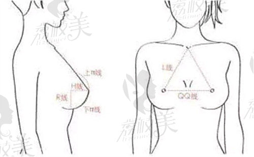 林沸騰隆胸技術(shù)好嗎？