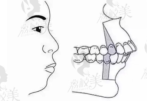 北京联合丽格柳春明医生正颌手术项目