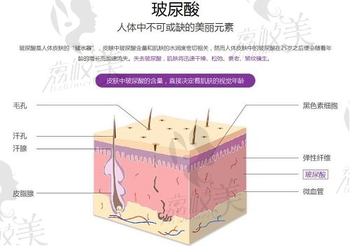 武汉艺星打玻尿酸多少钱