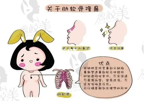 东莞缔美美容医院蒋翔峰做鼻子怎么样？