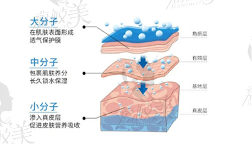 深圳不同分子玻尿酸