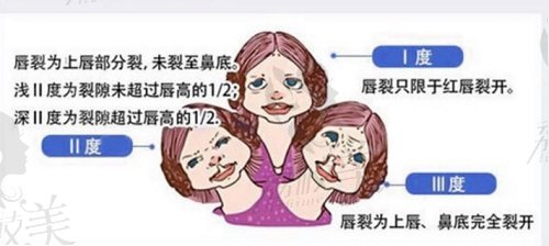 赵绛波医生唇腭裂修复手术技术