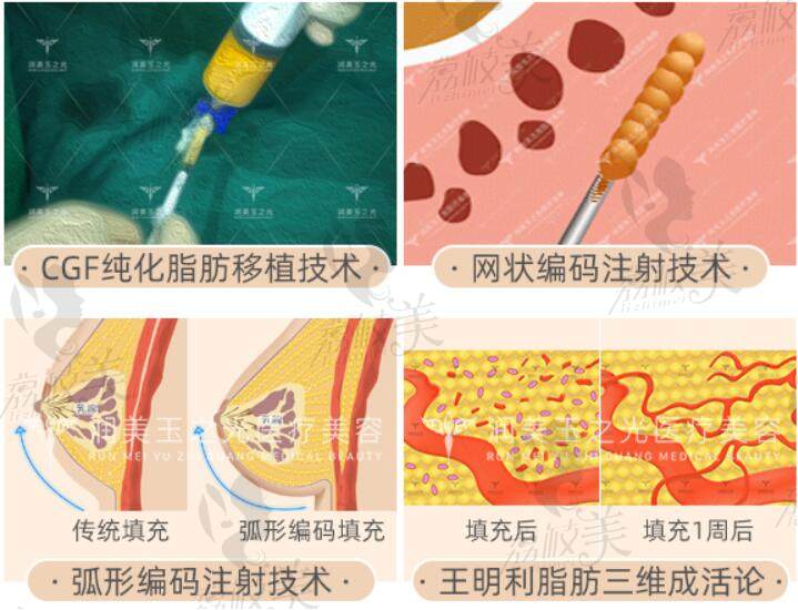 北京润美玉之光的技术怎么样