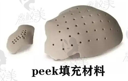 peek人工骨鼻基底假體填充