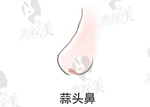 廣州美恩醫(yī)療美容鼻綜合手術(shù)怎么樣