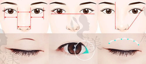 郭广科医生做双眼皮个性化制定双眼皮的手术方案
