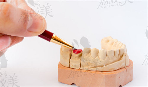 榆林种牙口腔医院哪家好