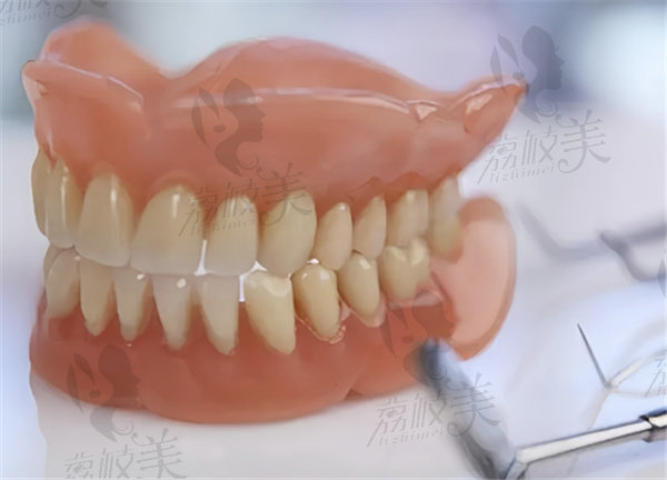 牙齿缺失的修复方式分别是什么