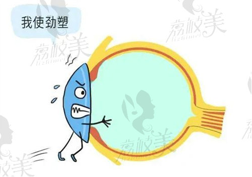 北京华德眼科医院角膜塑形镜价格表