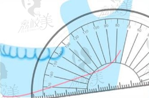 黃大勇醫(yī)生下頜角磨骨整形側面輪廓