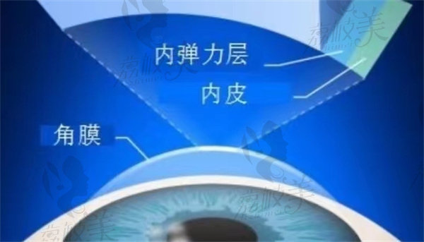 广州近视眼手术价格一览表