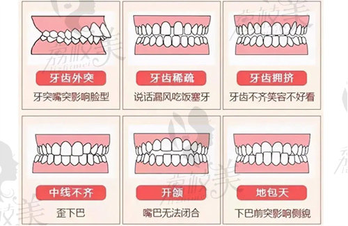 天津牙齿矫正大概要花费多少钱