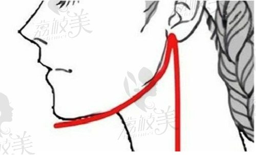 河南省中医一附院做下颌角手术的优势
