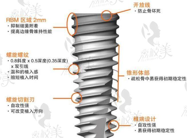 衡水可恩口腔醫(yī)院奧齒泰種植牙優(yōu)勢