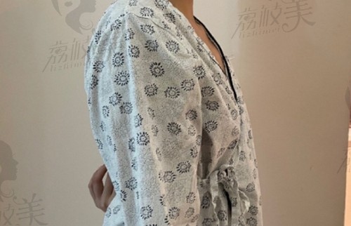 南京艺星医疗美容潘峰医生的曼托假体隆胸手术前图片