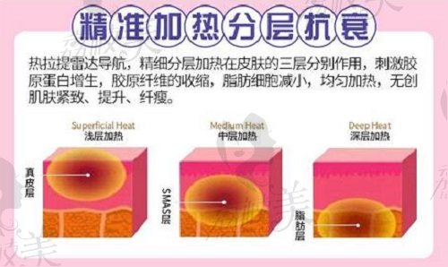 北京华韩做热拉提面部提升