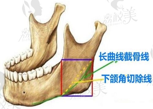 河东镐磨骨多少钱