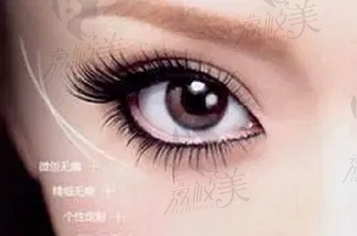 北京韶华王易彬医生双眼皮整形项目