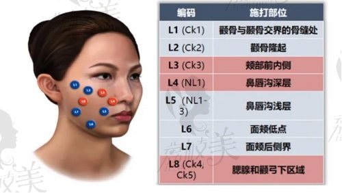 佛山美莱陈雯婷注射技术优势