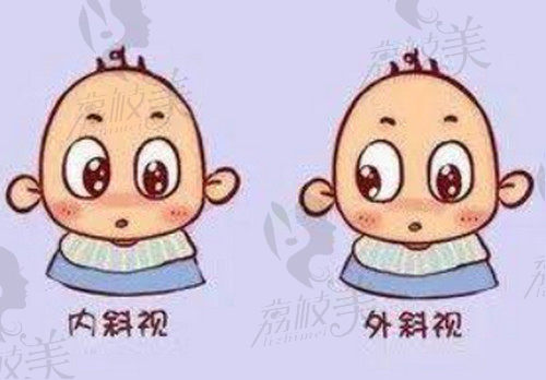 济南华视眼科医院王利华做儿童斜视手术技术扎实