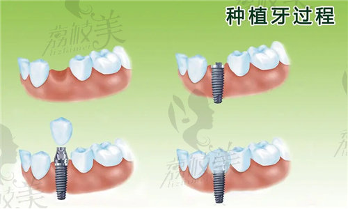 北京新北口腔上庄分院怎么样