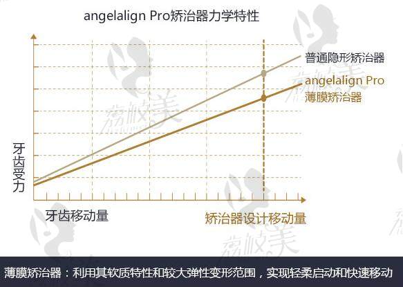 广州德伦口腔正畸怎么样？数字美学无托槽隐形矫治时代天使优势多