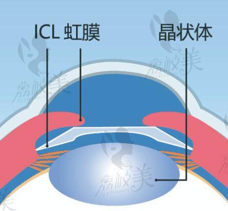 新视界眼科医院预约挂号途径有哪些