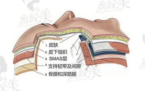 北京美媛荟PSV面部提升口碑评价