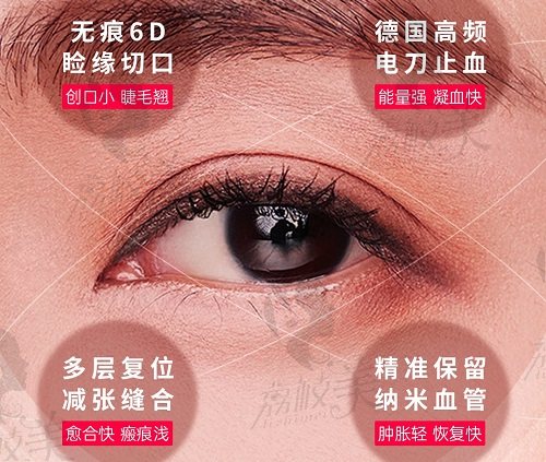 北京艺星双眼皮整形技术优势