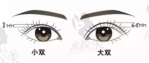 南京美婳医疗美容的双眼皮手术备受称赞