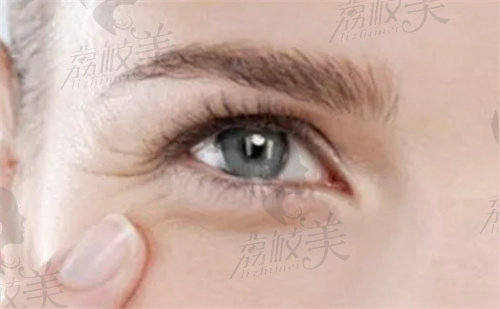 眼角下垂眼皮松弛有皱纹怎么改善？