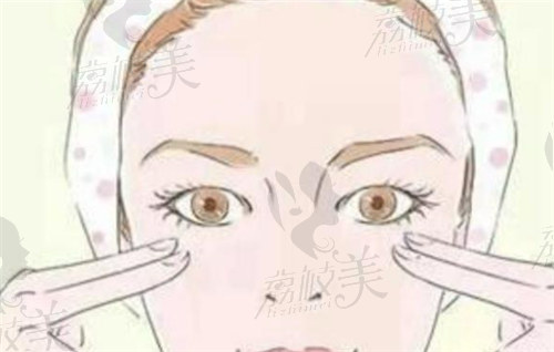 韩 式双眼皮和埋线双眼皮手术方式不同