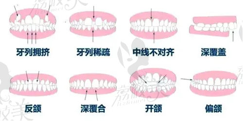 上海可恩口腔做矫正好不好