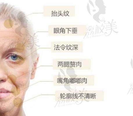 PST面部提升可以解决的面部衰老问题