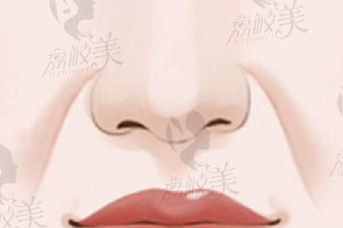 北京华韩高亚东医生做鼻子整形