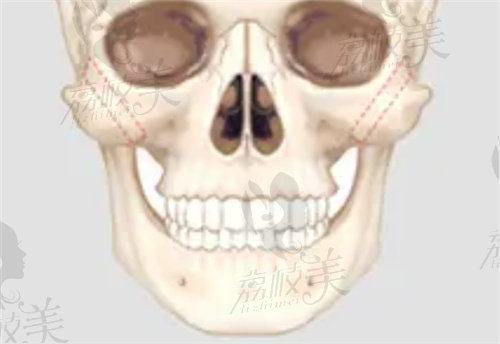 中信惠州醫(yī)院磨骨技術(shù)好