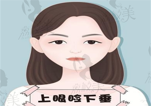 重庆上睑松弛矫正手术图