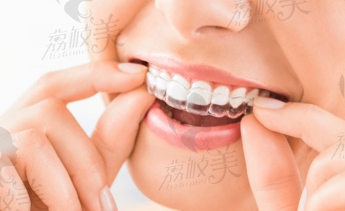 长沙矫正牙齿多少钱?